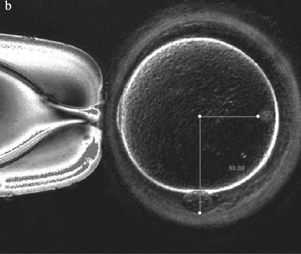Oocytes-with-meiotic-spindle-with-90°-shift-from-polar-body