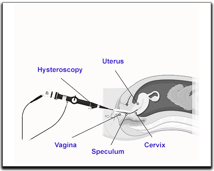Basic Services in IVF Clinic - Krishna IVF Clinic