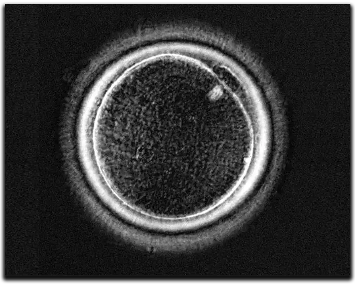 Poloscopy_Oocyte_Spindle_View
