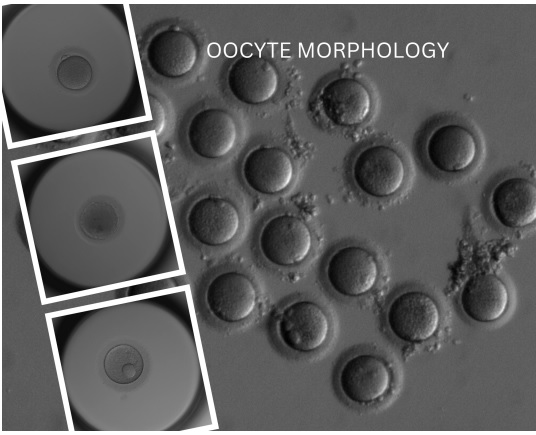 Oocyte-Morphology