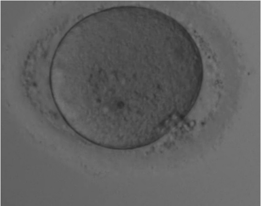 The-Art-of-Oocyte-Assessment-in-IVF
