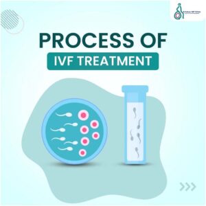 Overview-of-the-In-Vitro-Fertilization-Process-1