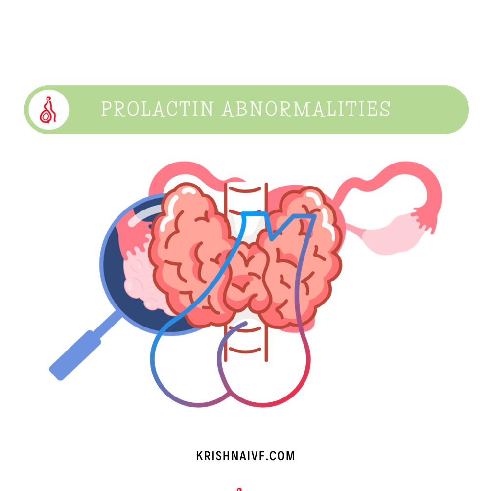 Prolactin-Abnormalities