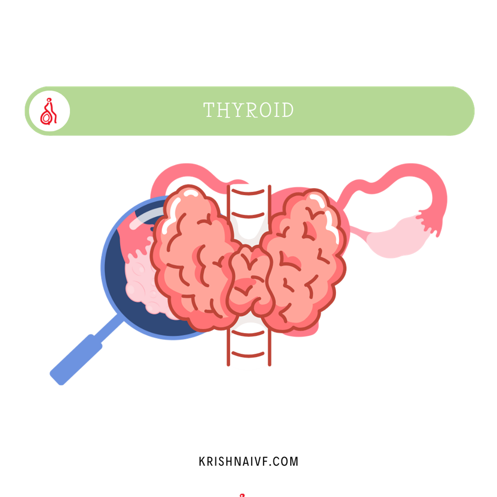 Thyroid-KIVF