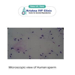 The-Microscopic-World-of-Human-Sperm