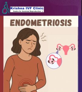 Do-You-Know-the-Symptoms-of-Endometriosis