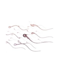 Immotile-Sperm-3