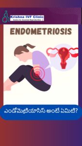 Understanding-Endometriosis-and-Infertility