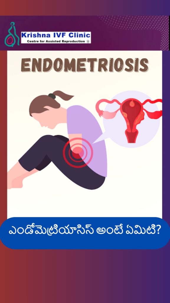 Understanding-Endometriosis-and-Infertility