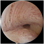 Minimally-Invasive-Solution-for-Womens-Health-and-Fertility2