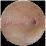 Minimally-Invasive-Solution-for-Womens-Health-and-Fertility3