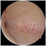 Minimally-Invasive-Solution-for-Womens-Health-and-Fertility4