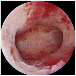 Minimally-Invasive-Solution-for-Womens-Health-and-Fertility6