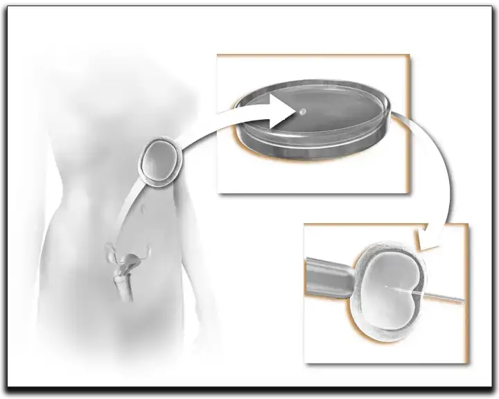 IVF-Clinic
