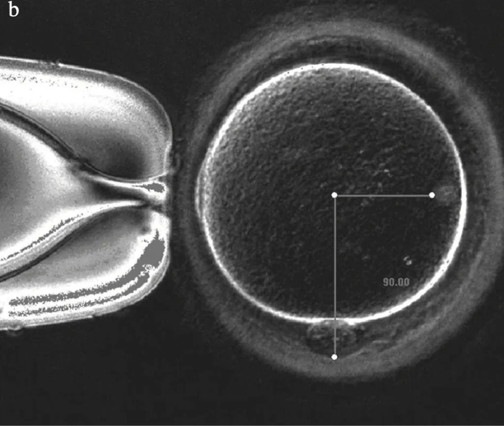 PolScope oocyte spindle imaging