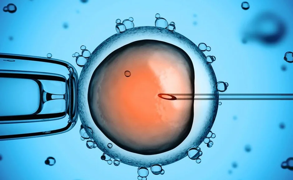 TESE ICSI reproductive procedure
