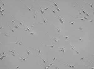 Why Delaying Male Fertility Testing Is a Costly Mistake