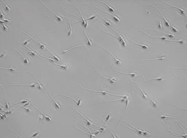 Why Delaying Male Fertility Testing Is a Costly Mistake