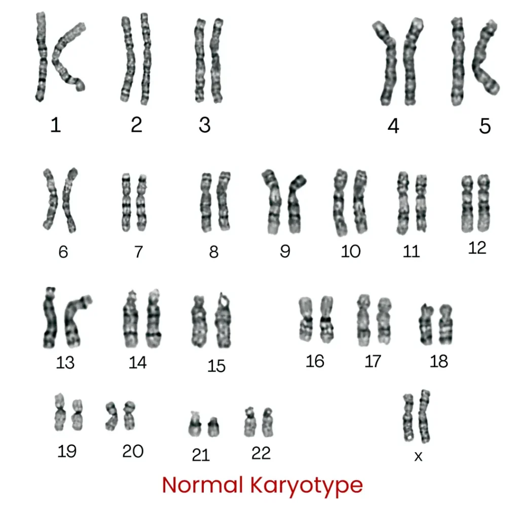 normal karyotype